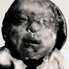 Autopsie prématurée - 2